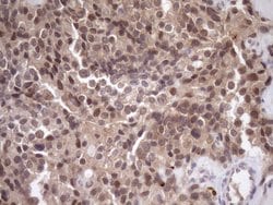 SCMH1 Monoclonal Antibody (OTI5E6), TrueMAB , OriGene 100 μL; Unconjugated:Antibodies,