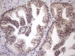 SCMH1 Monoclonal Antibody (OTI5E6), TrueMAB , OriGene 100 μL; Unconjugated:Antibodies,