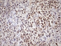 SCMH1 Monoclonal Antibody (OTI5E6), TrueMAB , OriGene 100 μL; Unconjugated:Antibodies,