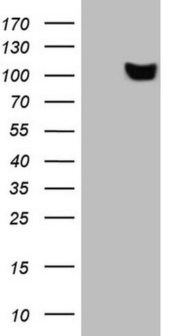 SCML2 Monoclonal Antibody (OTI1B1), TrueMAB , OriGene 100 &mu;L; Unconjugated:Antibodies,