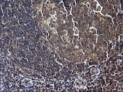 SCP2 Mouse anti-Human, Clone: OTI1E4, lyophilized, TrueMAB 100 &mu;g; Unconjugated:Antibodies,