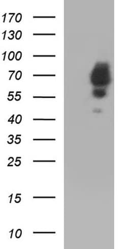 SCP2 Monoclonal Antibody (OTI1E4), TrueMAB , OriGene:Antibodies:Primary