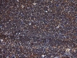 SCRN1 Monoclonal Antibody (OTI1E4), TrueMAB , OriGene 100 &mu;L; Unconjugated:Antibodies,