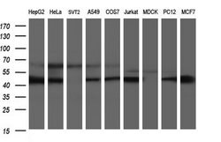 SCRN1 Monoclonal Antibody (OTI1E4), TrueMAB , OriGene 100 &mu;L; Unconjugated:Antibodies,