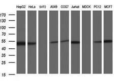 SCRN1 Mouse anti-Human, Rat, Clone: OTI1F2, lyophilized, TrueMAB 100 &mu;g | Buy Online | Origene Technologies | Fisher Scientific