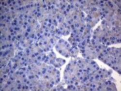SDHB Mouse anti-Human, Clone: OTI2A1, lyophilized, TrueMAB 100 &mu;g; Unconjugated:Antibodies,