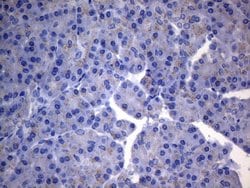SDHB Monoclonal Antibody (OTI2A1), TrueMAB , OriGene 100 &mu;L; Unconjugated:Antibodies,