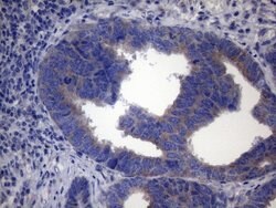 SDHB Mouse anti-Human, Clone: OTI2A1, lyophilized, TrueMAB 100 &mu;g; Unconjugated:Antibodies,