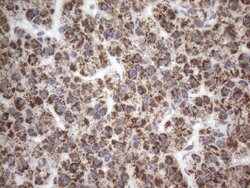 SDHB Mouse anti-Human, Clone: OTI2A1, lyophilized, TrueMAB 100 &mu;g; Unconjugated:Antibodies,