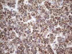 SDHB Monoclonal Antibody (OTI2A1), TrueMAB , OriGene 100 &mu;L; Unconjugated:Antibodies,