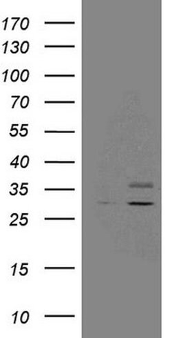 SDHB Mouse anti-Human, Clone: OTI2A1, lyophilized, TrueMAB 100 &mu;g; Unconjugated:Antibodies,