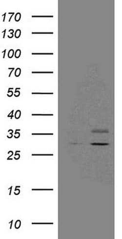 SDHB Monoclonal Antibody (OTI2A1), TrueMAB , OriGene 100 &mu;L; Unconjugated:Antibodies,
