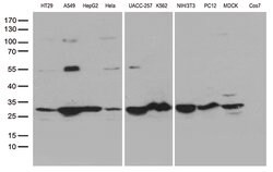 SDHB Mouse anti-Human, Clone: OTI2A1, lyophilized, TrueMAB 100 &mu;g; Unconjugated:Antibodies,