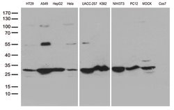 SDHB Monoclonal Antibody (OTI2A1), TrueMAB , OriGene 100 &mu;L; Unconjugated:Antibodies,