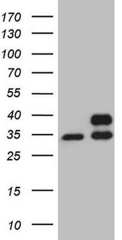 SDHB Monoclonal Antibody (OTI1E4), TrueMAB , OriGene 100 &mu;L; Unconjugated:Antibodies,