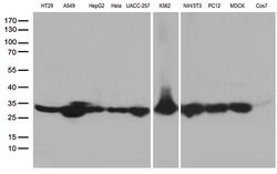 SDHB Monoclonal Antibody (OTI1E4), TrueMAB , OriGene 100 &mu;L; Unconjugated:Antibodies,