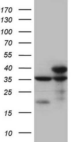 SDHB Mouse anti-Human, Clone: OTI2A3, lyophilized, TrueMAB 100 &mu;g; Unconjugated:Antibodies,