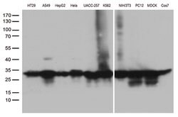 SDHB Mouse anti-Human, Clone: OTI2A3, lyophilized, TrueMAB 100 &mu;g; Unconjugated:Antibodies,