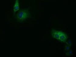 SDR9C7 Monoclonal Antibody (OTI12A11), TrueMAB , OriGene 100 &mu;L; Unconjugated:Antibodies,