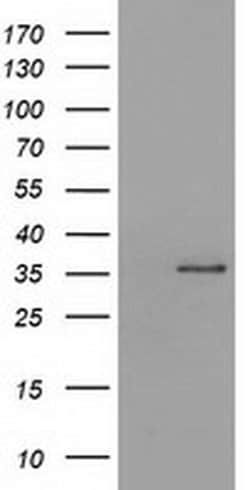 SDR9C7 Monoclonal Antibody (OTI10B4), TrueMAB , OriGene 100 &mu;L; Unconjugated:Antibodies,