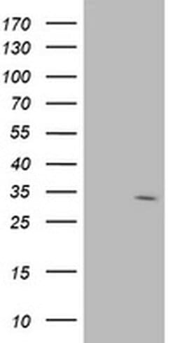 SDR9C7 Monoclonal Antibody (OTI10F11), TrueMAB , OriGene 30 &mu;L; Unconjugated:Anticuerpos