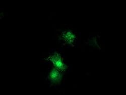 SDS Monoclonal Antibody (OTI1H5), TrueMAB , OriGene 100 &mu;L; Unconjugated:Antibodies,
