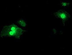 SDS Monoclonal Antibody (OTI2C11), TrueMAB , OriGene 100 &mu;L; Unconjugated:Antibodies,