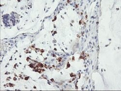 SDS Monoclonal Antibody (OTI1H5), TrueMAB , OriGene 100 &mu;L; Unconjugated:Antibodies,