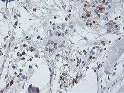SDS Monoclonal Antibody (OTI2C11), TrueMAB , OriGene:Antibodies:Primary