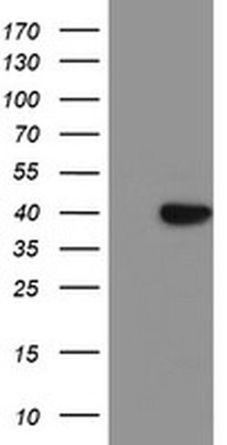SDS Monoclonal Antibody (OTI4E1), TrueMAB , OriGene 100 &mu;L; Unconjugated:Antibodies,