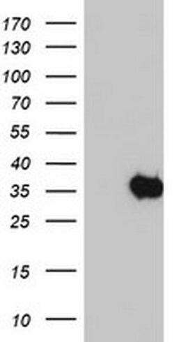 SDS Monoclonal Antibody (OTI1H5), TrueMAB , OriGene 100 &mu;L; Unconjugated:Antibodies,