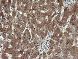 SDSL Mouse anti-Human, Clone: OTI1A8, lyophilized, TrueMAB 100 &mu;g; Unconjugated:Antibodies,