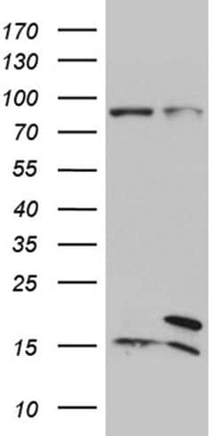 SEC11A Monoclonal Antibody (OTI1A11), TrueMAB , OriGene 100 &mu;L; Unconjugated:Antibodies,