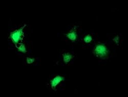 SEC14L2 Mouse anti-Human, Clone: OTI1F10, lyophilized, TrueMAB 100 &mu;g;