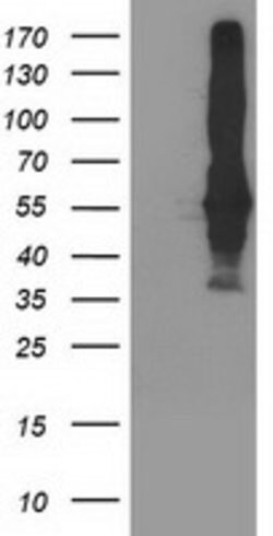 SEC14L2 Mouse anti-Human, Clone: OTI1F10, lyophilized, TrueMAB 100 &mu;g;