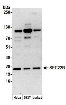 SEC22B Rabbit anti-Human, Polyclonal, Bethyl Laboratories 10 &mu;L; Unconjugated:Antibodies,