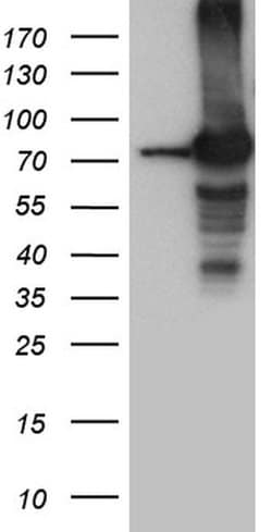 SEC23B Monoclonal Antibody (OTI8F3), TrueMAB , OriGene:Anticuerpos:Anticuerpos