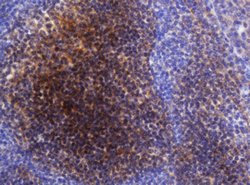 SELENBP1 Mouse anti-Human, Clone: OTI3D2, lyophilized, TrueMAB 100 &mu;g;