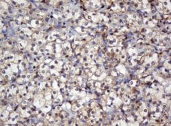 SELENBP1 Mouse anti-Human, Clone: OTI3D2, lyophilized, TrueMAB 100 &mu;g;
