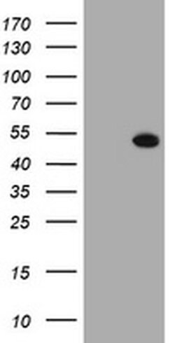SELENBP1 Monoclonal Antibody (OTI3D4), TrueMAB , OriGene 30 &mu;L; Unconjugated:Antibodies,
