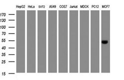SELENBP1 Mouse anti-Human, Clone: OTI3D2, lyophilized, TrueMAB 100 &mu;g;