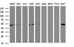 SELENBP1 Monoclonal Antibody (OTI2B12), TrueMAB , OriGene 30 &mu;L; Unconjugated:Antibodies,
