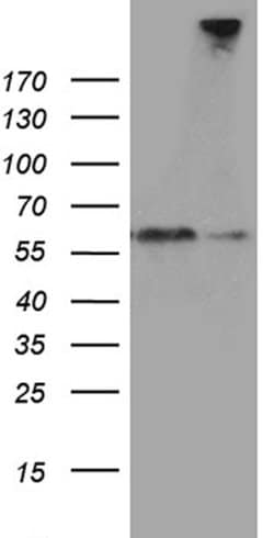 SEMA3G Mouse anti-Human, Clone: OTI8B10, lyophilized, TrueMAB 100 &mu;g;