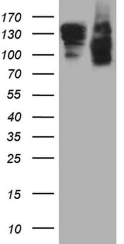 SEMA4D Monoclonal Antibody (OTI6G1), TrueMAB , OriGene:Antibodies:Primary