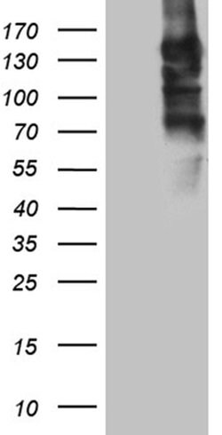 SEMA4D Monoclonal Antibody (OTI6G1), TrueMAB , OriGene 100 &mu;L; Unconjugated:Antibodies,