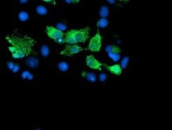 SENP2 Monoclonal Antibody (OTI1C4), TrueMAB , OriGene 100 &mu;L; Unconjugated:Antibodies,