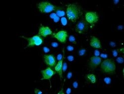 SENP2 Monoclonal Antibody (OTI3B12), TrueMAB , OriGene 100 &mu;L; Unconjugated:Antibodies,