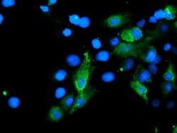 SENP2 Monoclonal Antibody (OTI3D12), TrueMAB , OriGene 100 &mu;L; Unconjugated:Antibodies,