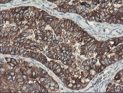 SENP2 Mouse anti-Human, Clone: OTI1B8, lyophilized, TrueMAB 100 &mu;g;
