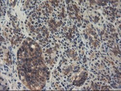 SENP2 Mouse anti-Human, Clone: OTI1B8, lyophilized, TrueMAB 100 &mu;g;